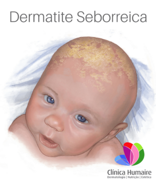 Dermatite Seborreica - ClinicaHumaire